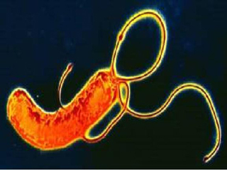 helicobacter_pylori_02